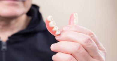 How Long Do Dentures Last: Lifespan and Maintenance